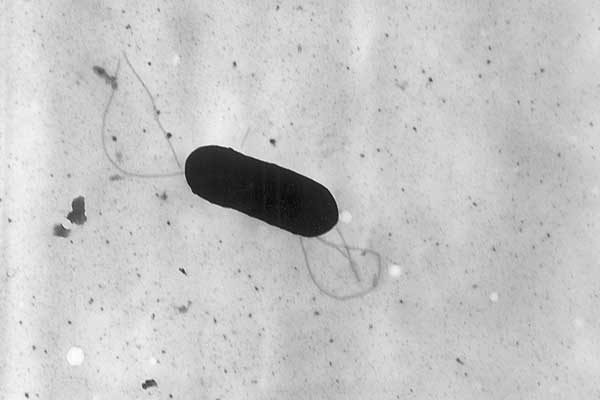 The Listeria monocytogenes bacterium up close